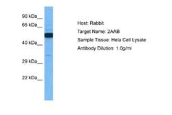 PPP2R1B Rabbit anti-Human, Polyclonal, Novus Biologicals 0.1 mL | Buy Online | Novus Biologicals | Fisher Scientific